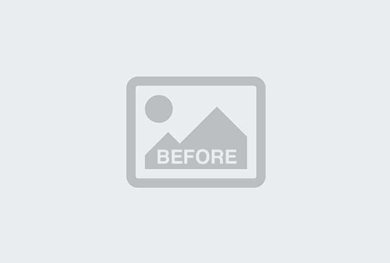 Before Image: Matrix Pro RF Applicator Face - front