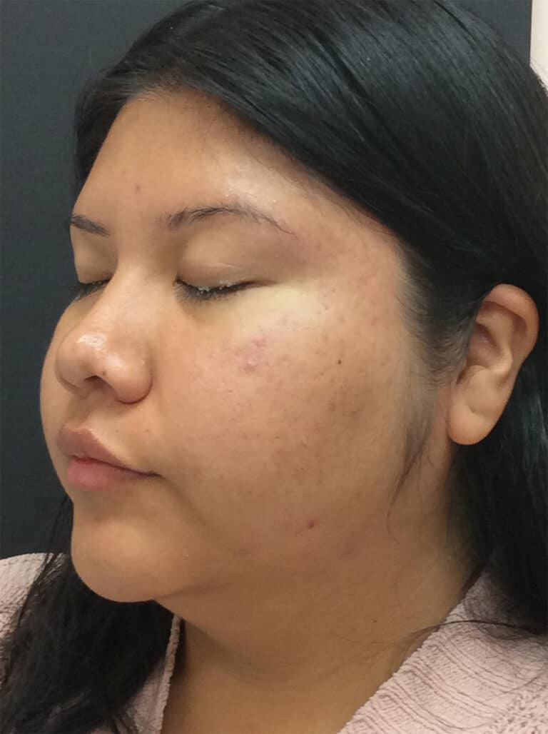 After Image: Diamond Glow - left-front-oblique