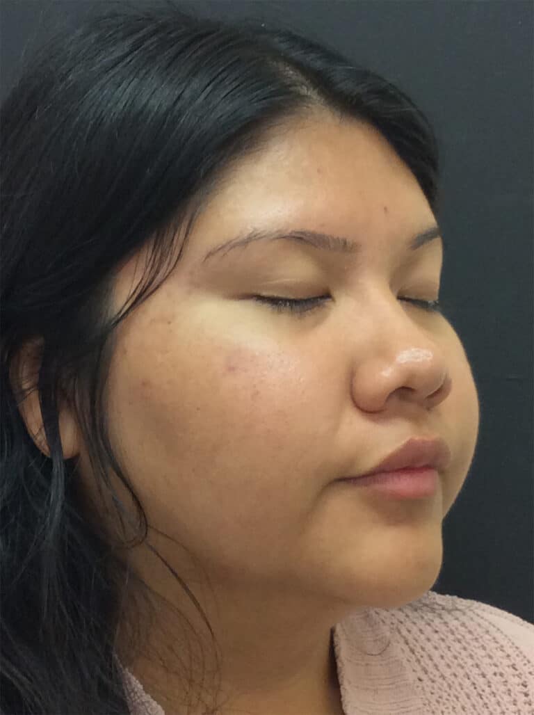 After Image: Diamond Glow - right-front-oblique