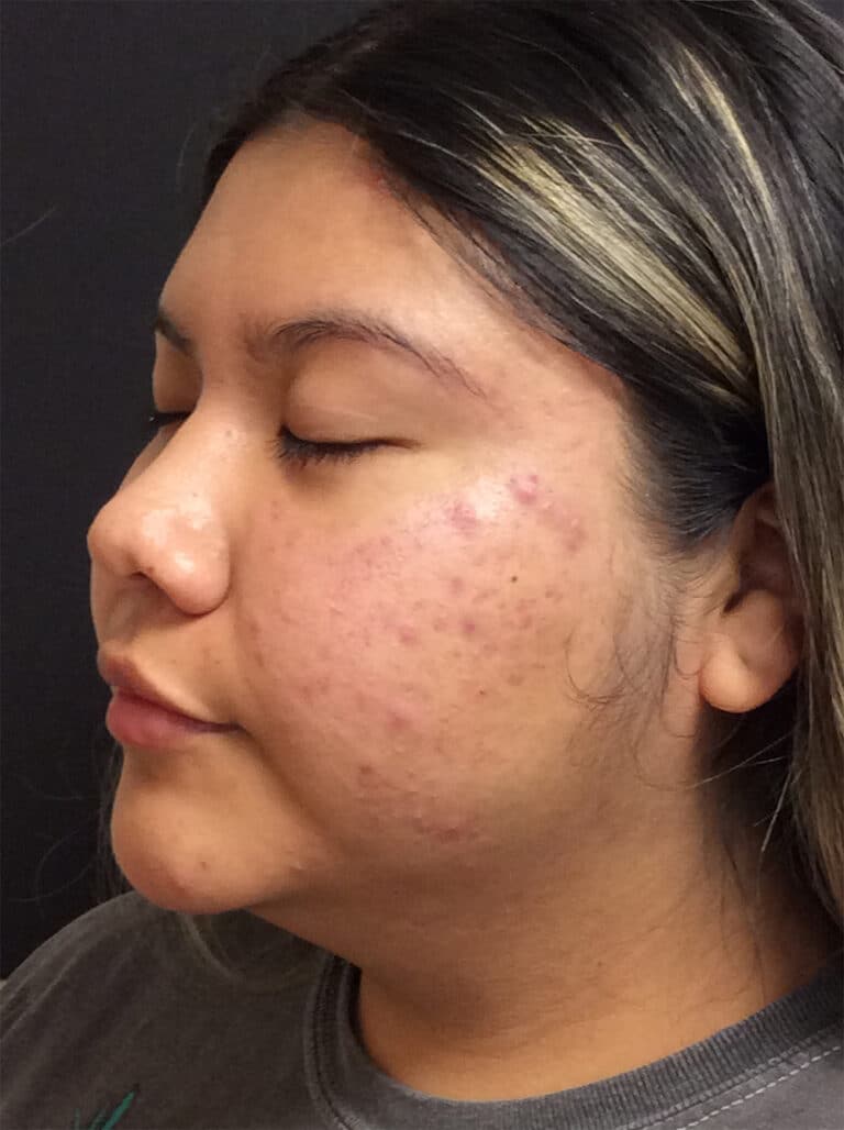 Before Image: Diamond Glow - left-front-oblique