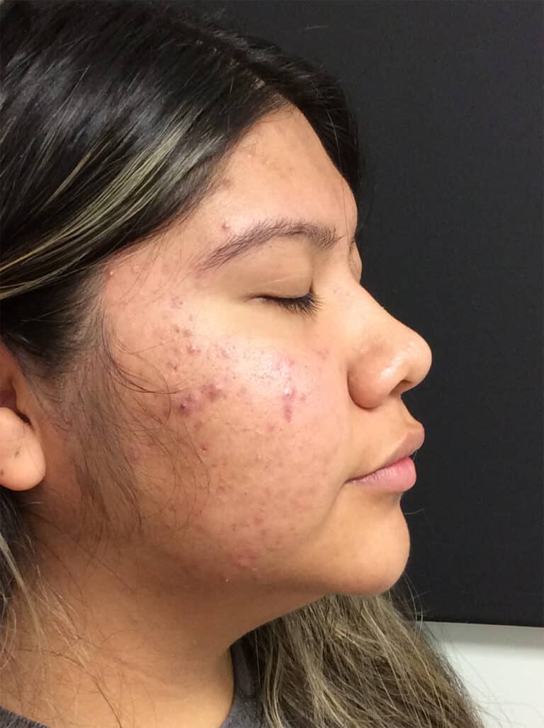 Before Image: Diamond Glow - right-front-oblique